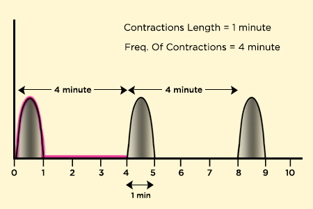 contraction frequency