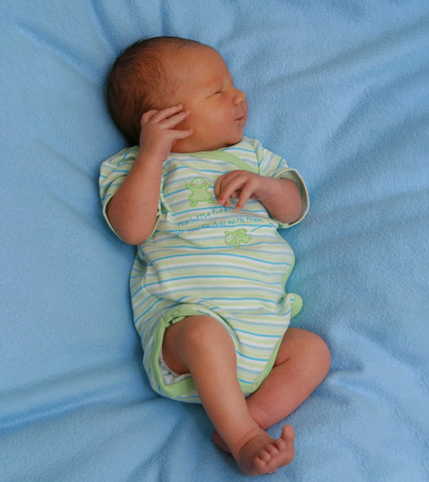 Newborn Jaundice: Signs, Causes, Treatment, And Prevention